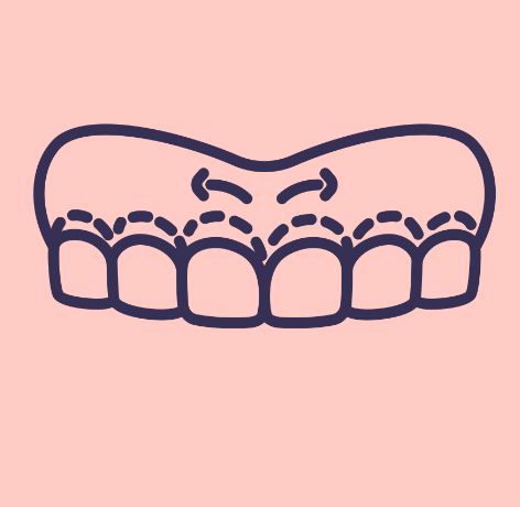 Stylized line drawing of upper teeth and gums on a pink background