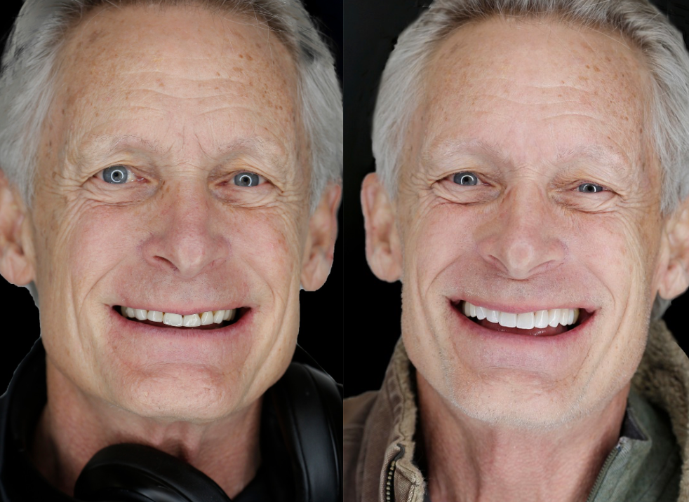 Side-by-side portraits of a smiling man with gray hair, wearing headphones in one image.