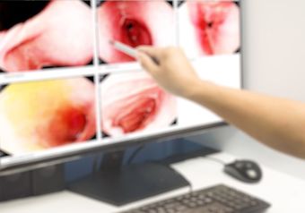 Endoscopy — Bakersfield, CA — American Digestive Liver & Nutritional Disease Center
