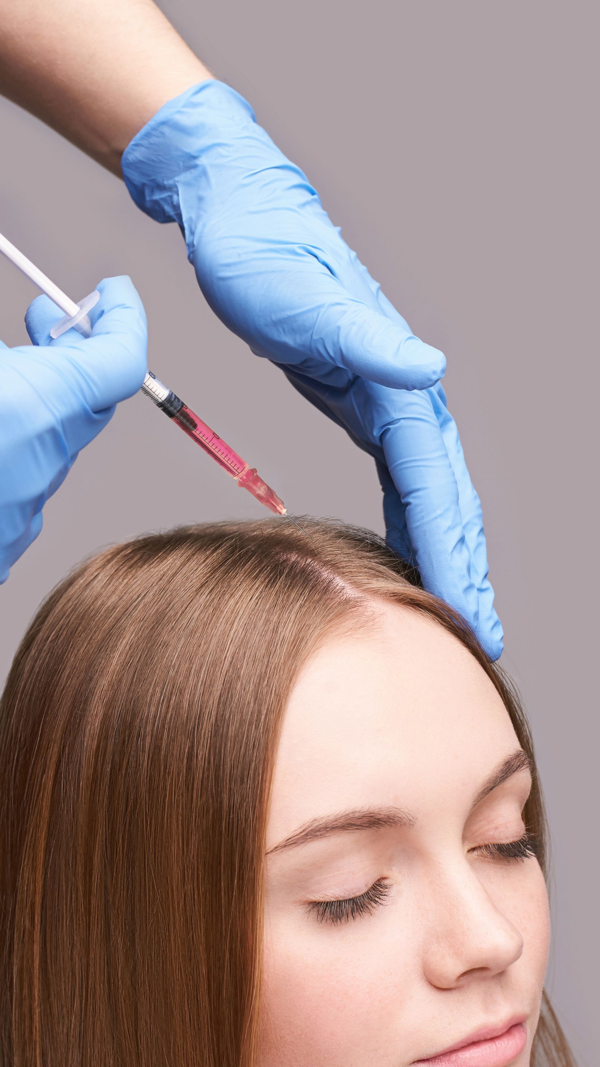 Melasma & Pigmentation | Toronto | Anti-Aging Clinic Toronto