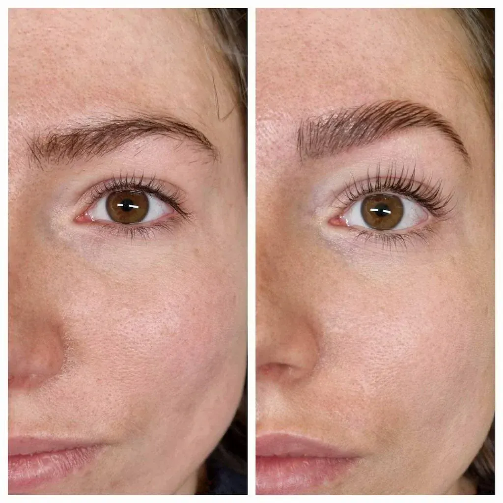 avant apres d'un rehaussement de cils et sourcils browlift