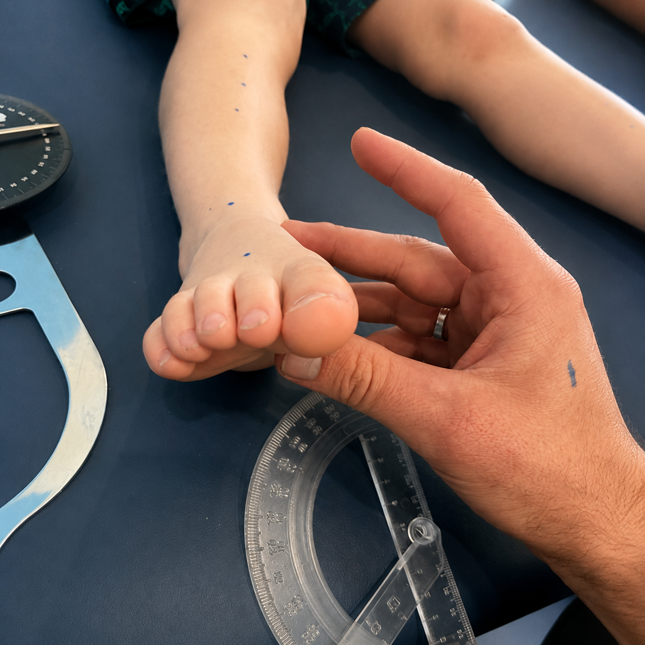 Adult Hand Holding a Child’s Foot While Measuring With a Clear Plastic Protractor on a Table — Lord Street Podiatry in Port Macquarie, NSW