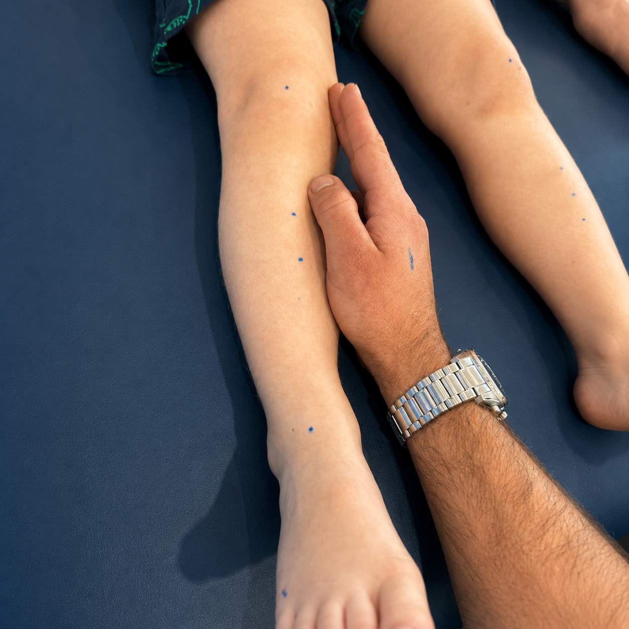 Person Measuring a Child’s Leg on a Blue Mat With a Hand and Wristwatch Visible — Lord Street Podiatry in Port Macquarie, NSW