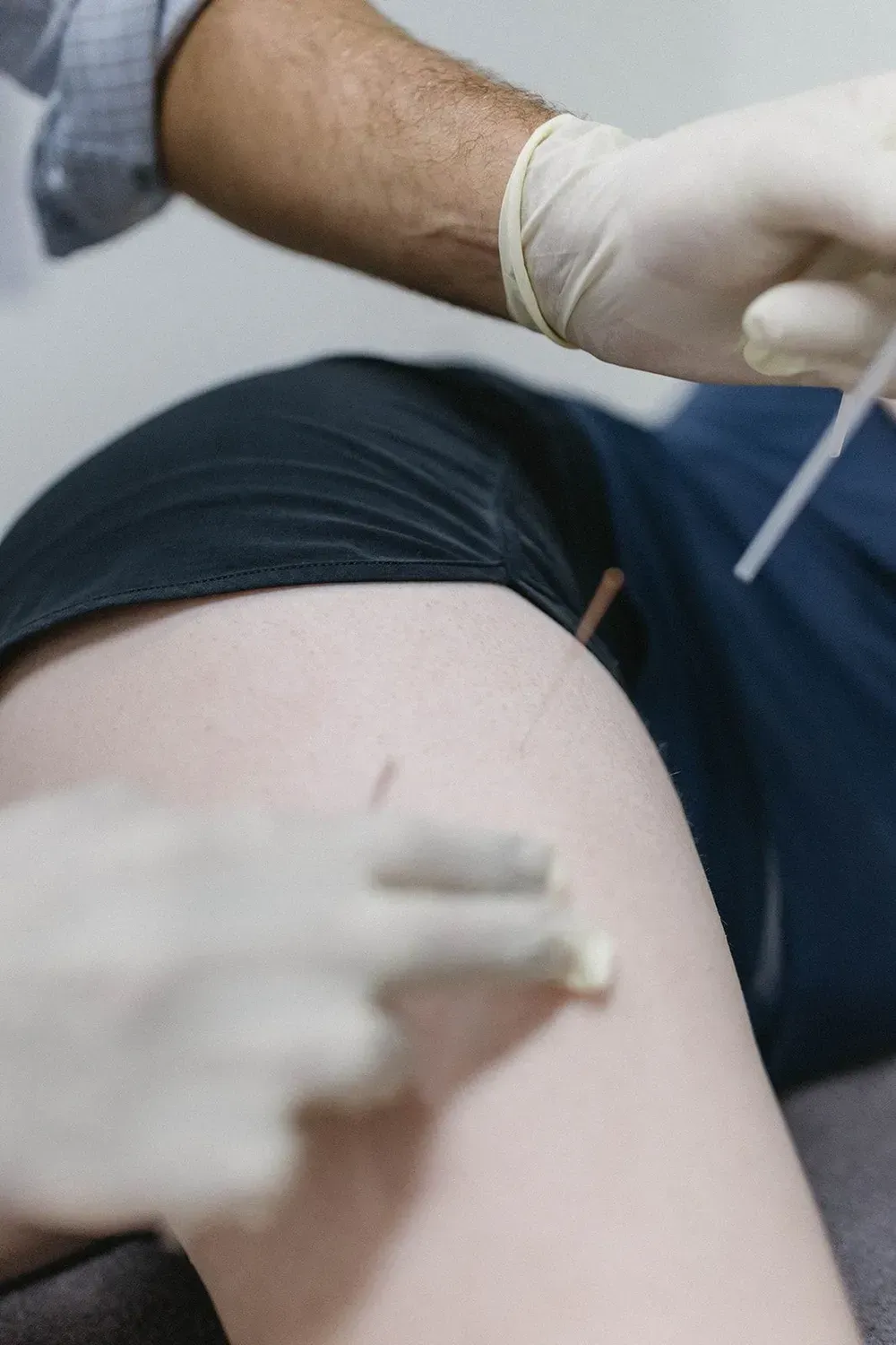 Medical Professional Administering an Injection Into a Patient’s Upper Arm With Gloved Hands — Lord Street Podiatry in Port Macquarie, NSW