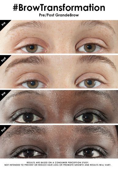 a before and after photo of a woman 's eyebrows