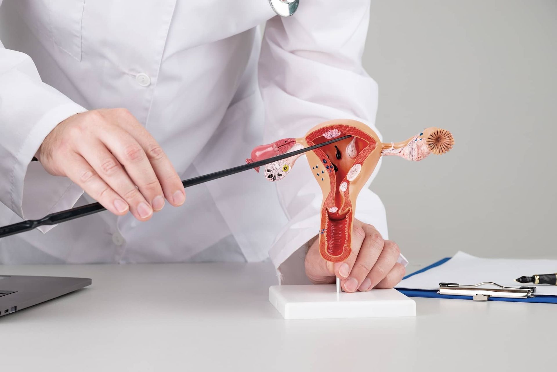 Cervix Gynaecologist