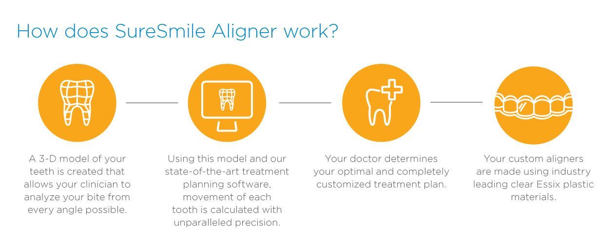 A diagram showing how sure smile aligner works.