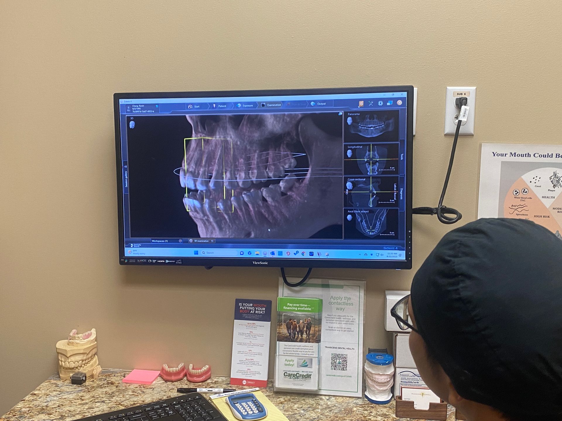 3D Cone Beam Imaging