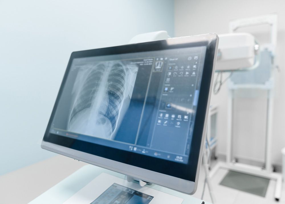 X-Ray Studies