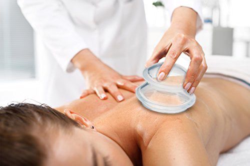 Cupping Techniques