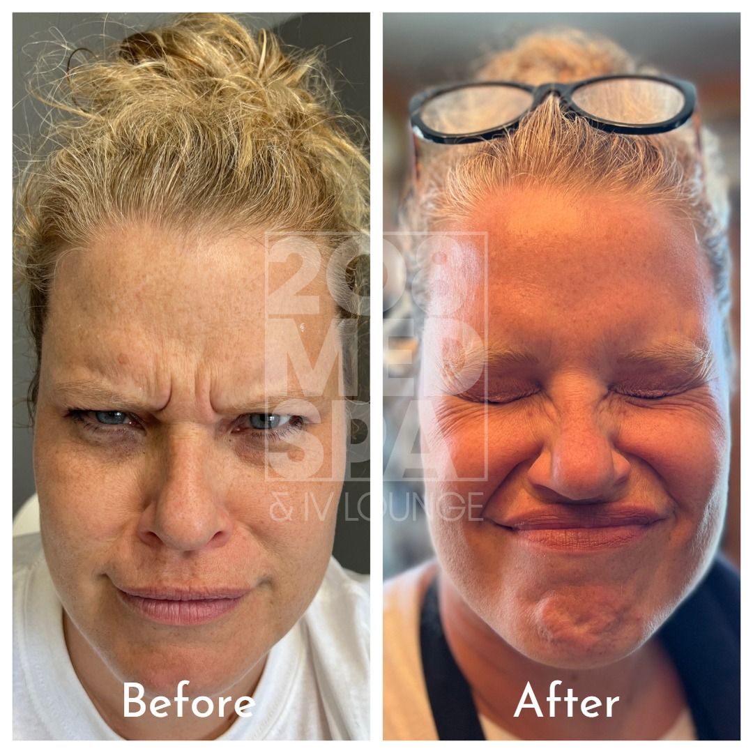 A before and after photo of a woman with glasses
