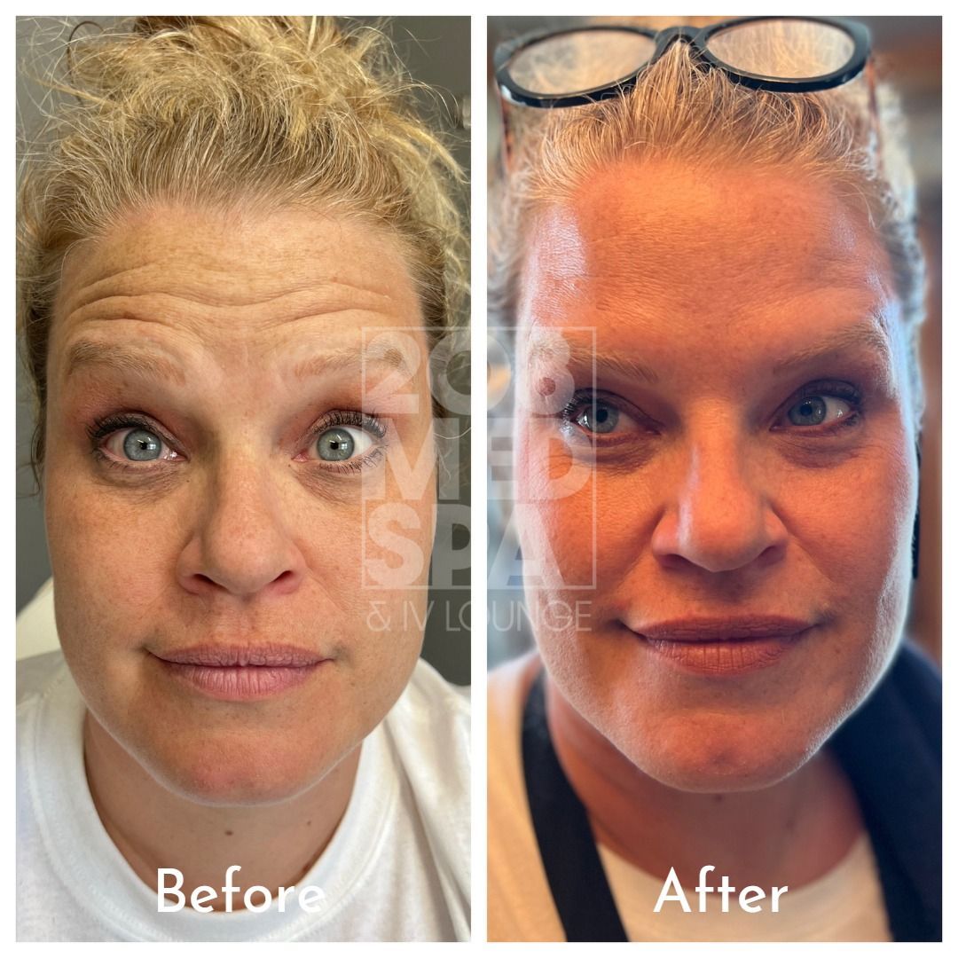A before and after photo of a woman 's face