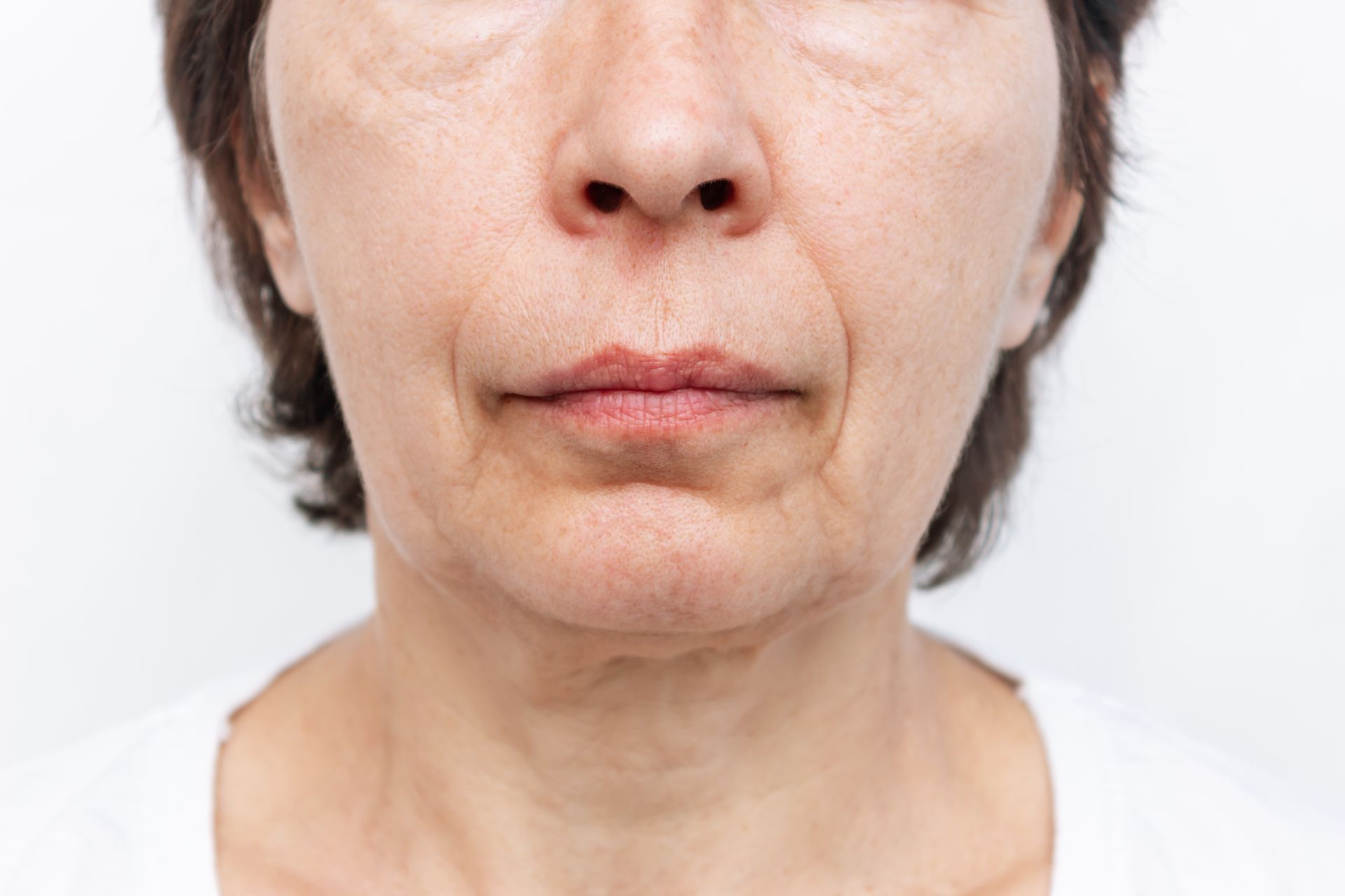 Close-up of a person's face showing wrinkles and skin discoloration; mouth, nose, and eyes are visible.