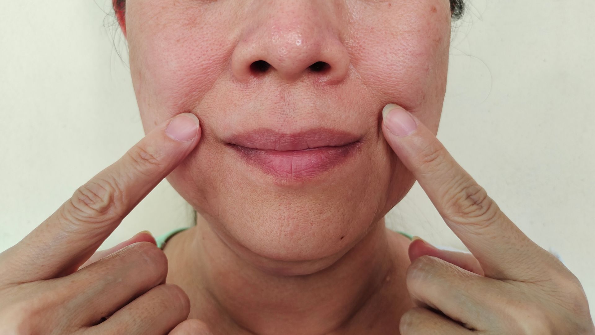 Woman pointing to smile lines on her cheeks.