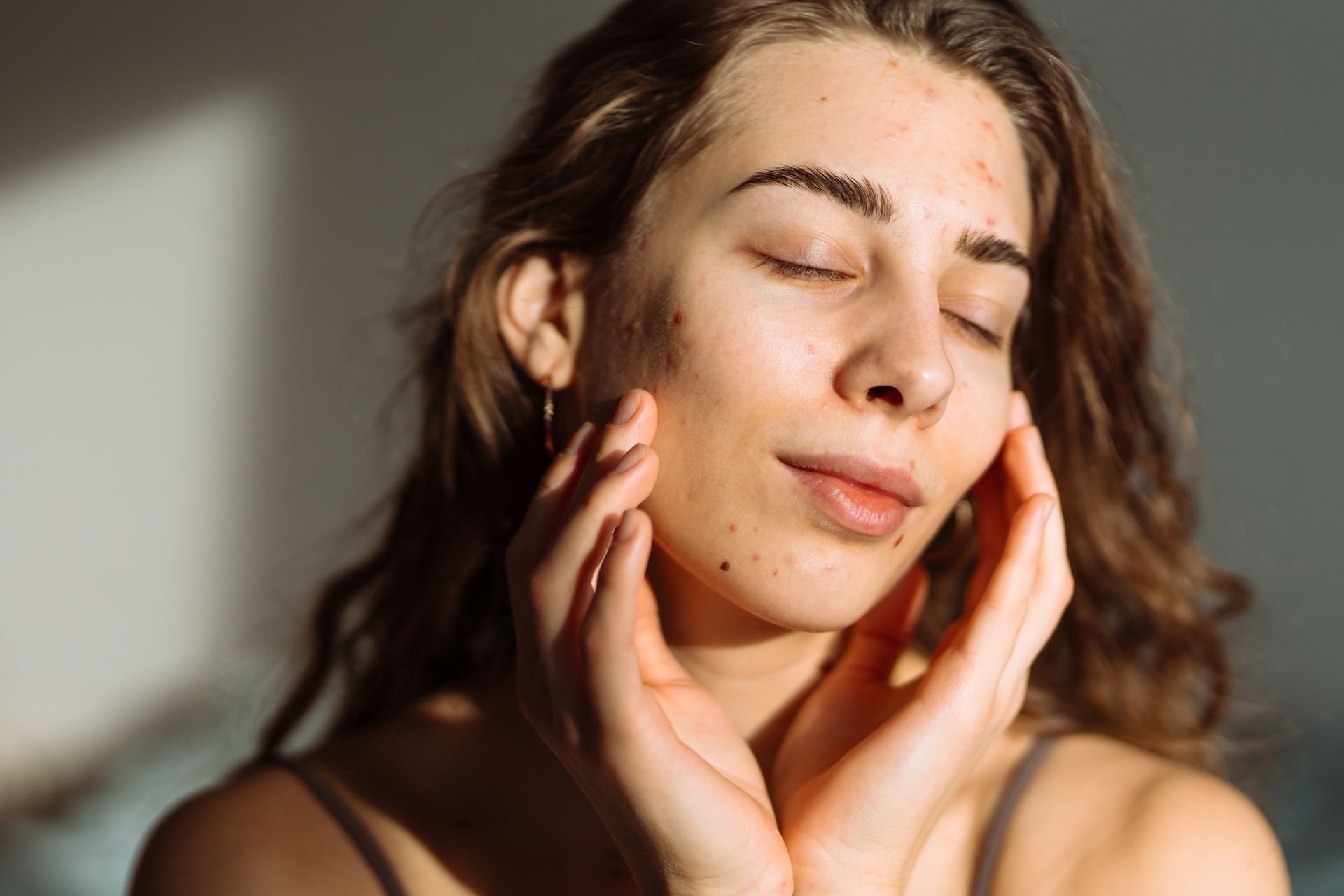 Woman with closed eyes, touching her cheeks, illuminated by sunlight; blemishes visible on her face.