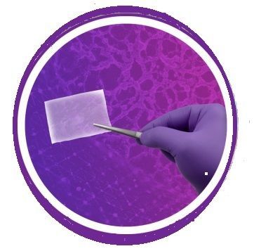 wound mesh