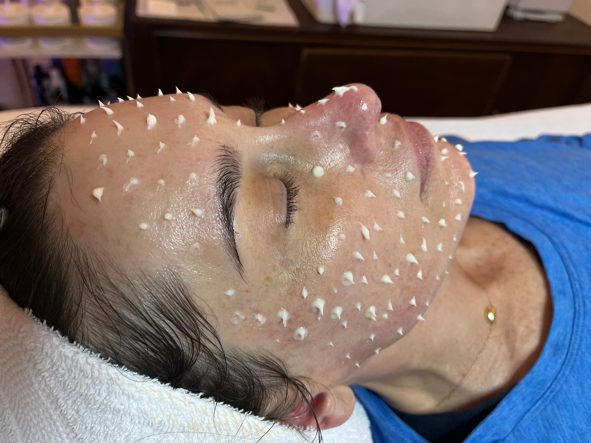 A person lying on a spa bed receiving a facial treatment with white cream applied in distinct, evenly spaced dots.
