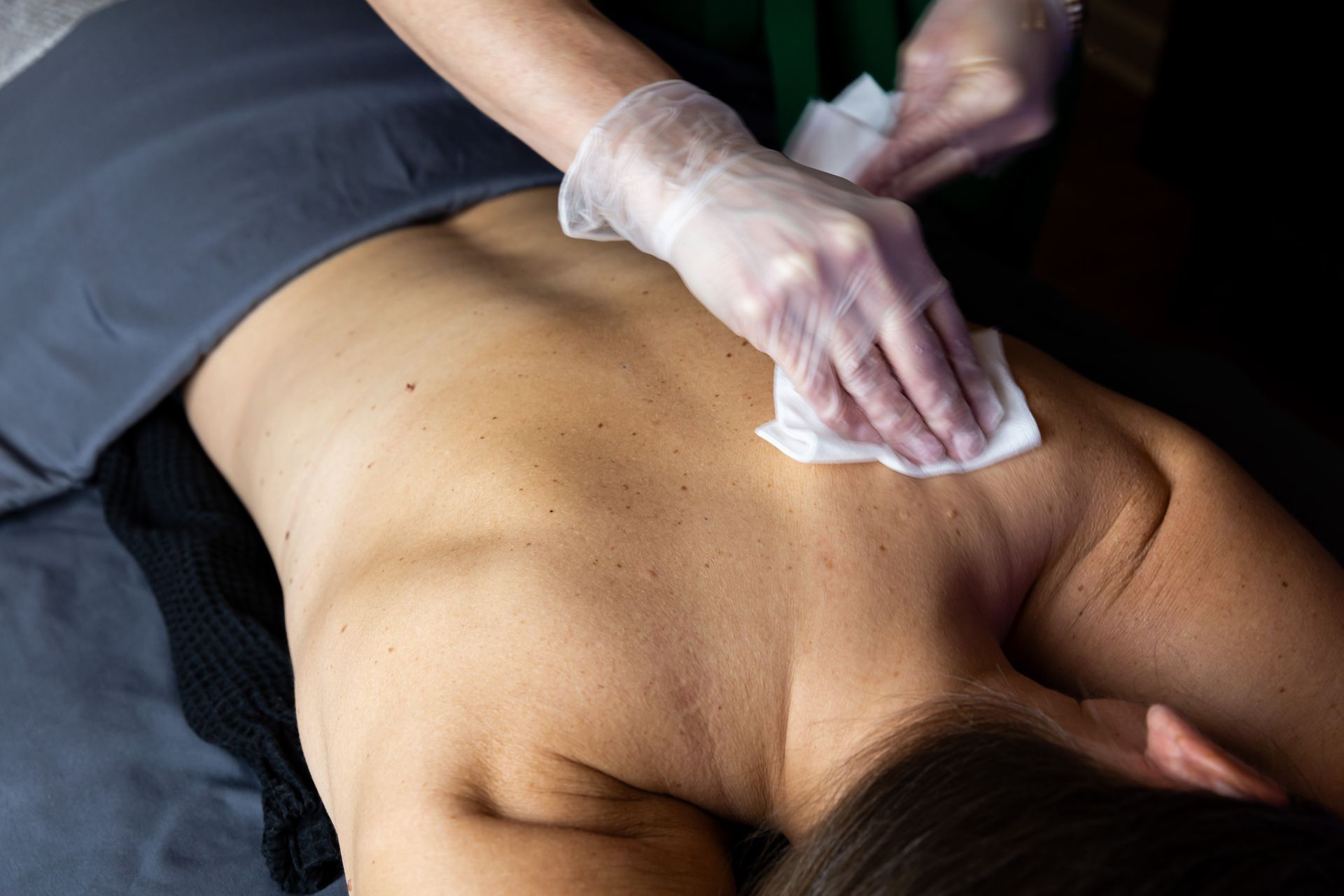A person in clear gloves uses a wipe to clean the skin on someone's back.