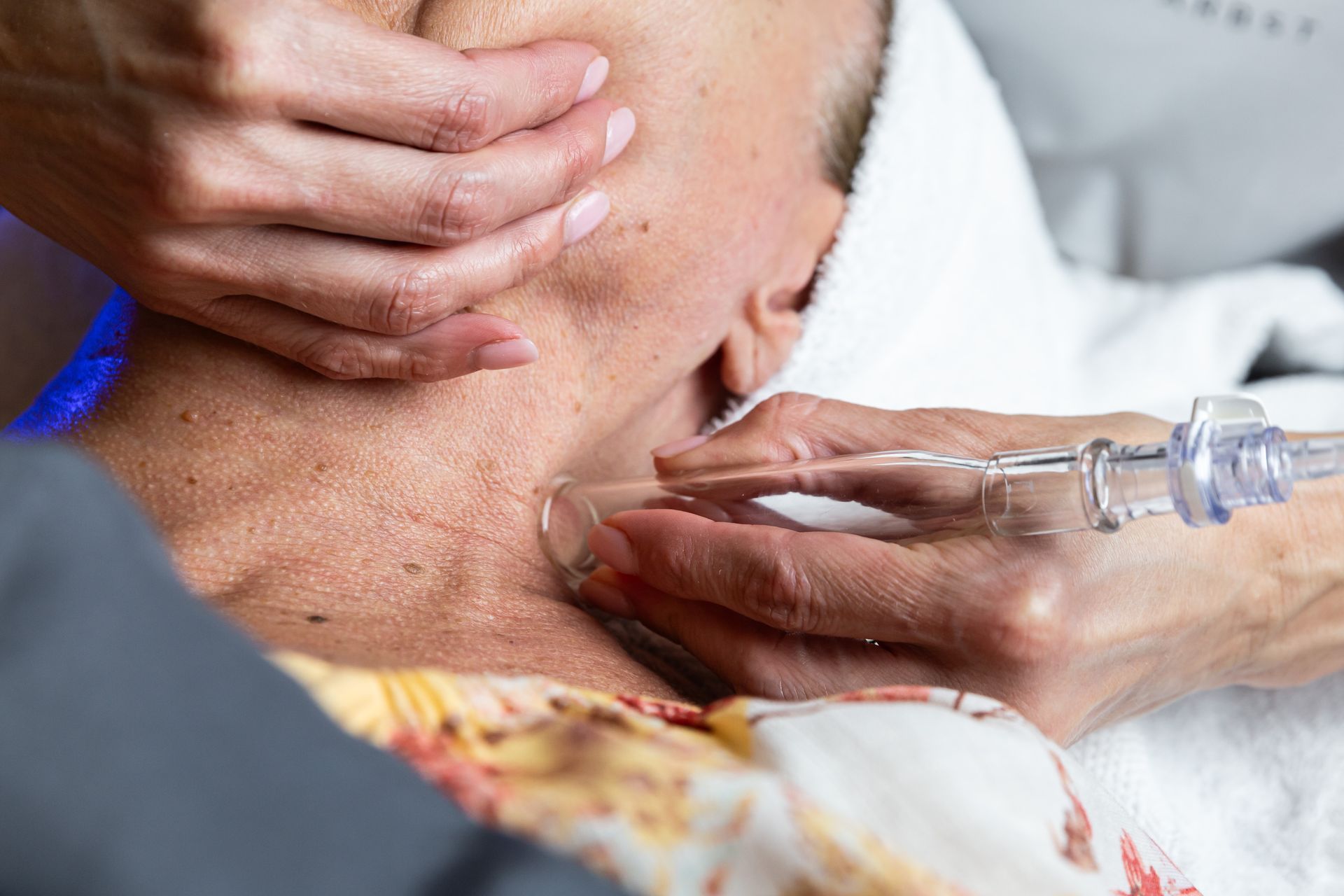 A person uses a glass suction device on the neck of a client lying on a table.
