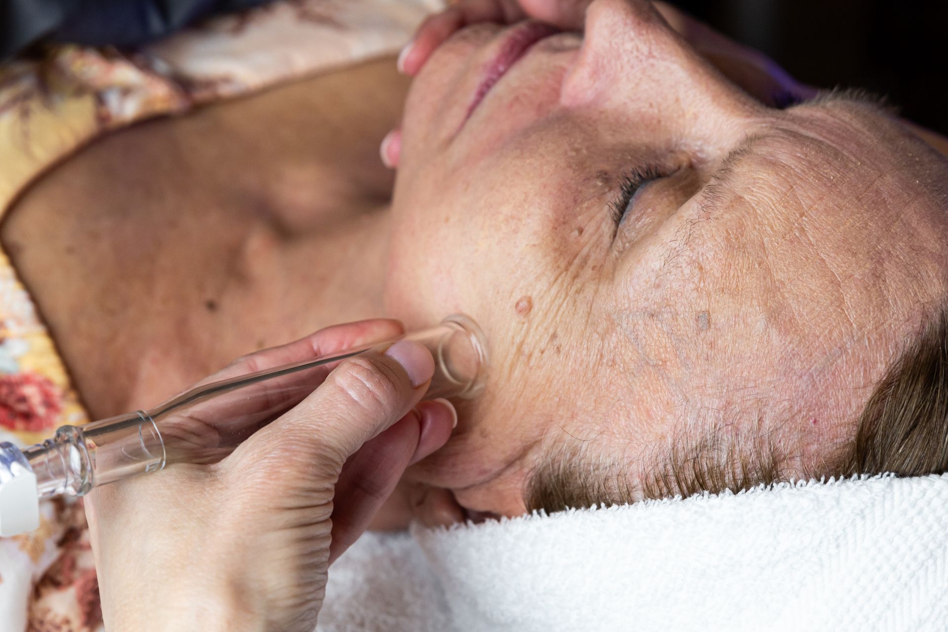 A practitioner uses a glass suction device on a person's cheek during a professional facial treatment.