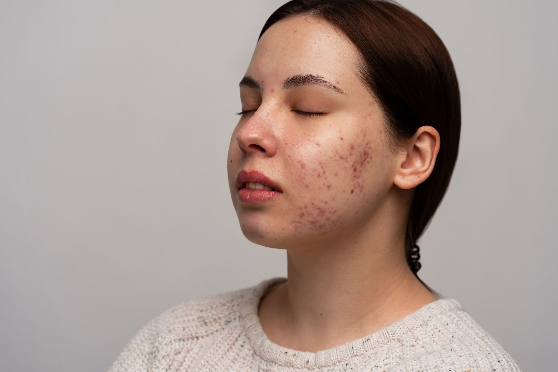 A person with eyes closed, wearing a cream-colored sweater against a plain background, showing visible skin texture.