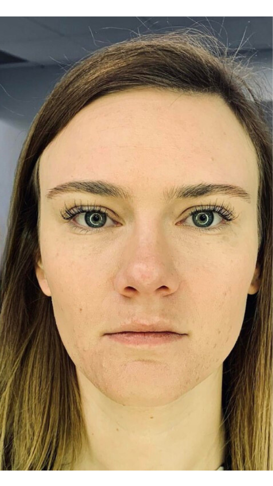 A person with shoulder-length brown hair and light eyes looking directly at the camera with a neutral expression.