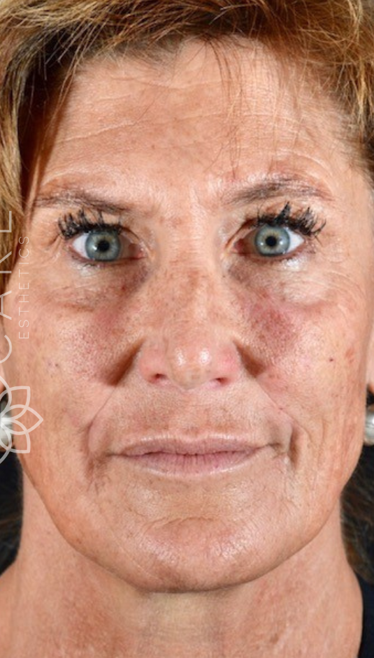 A frontal portrait of a person with light skin, looking directly at the camera with a neutral expression.