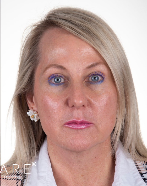 A blonde person wearing a white collared shirt and plaid jacket, facing forward with a neutral expression.