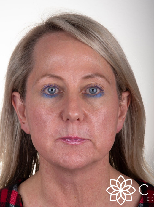 A forward-facing headshot of a person with blonde hair, light skin, and blue eyeshadow, set against a plain background.