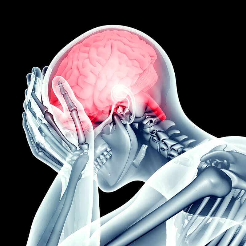 NEUROCIENCIAS DR. GERARDO QUIÑONES - Migraña