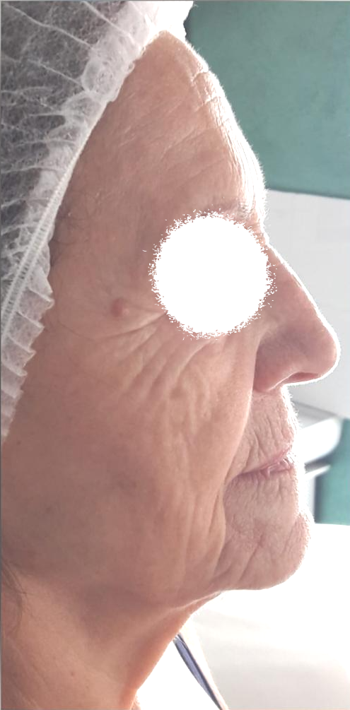 un primo piano del viso di una donna anziana che indossa un cappello di plastica .