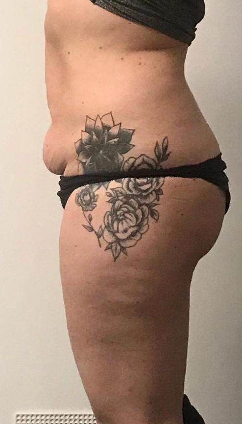 una donna con un tatuaggio floreale sulla coscia .