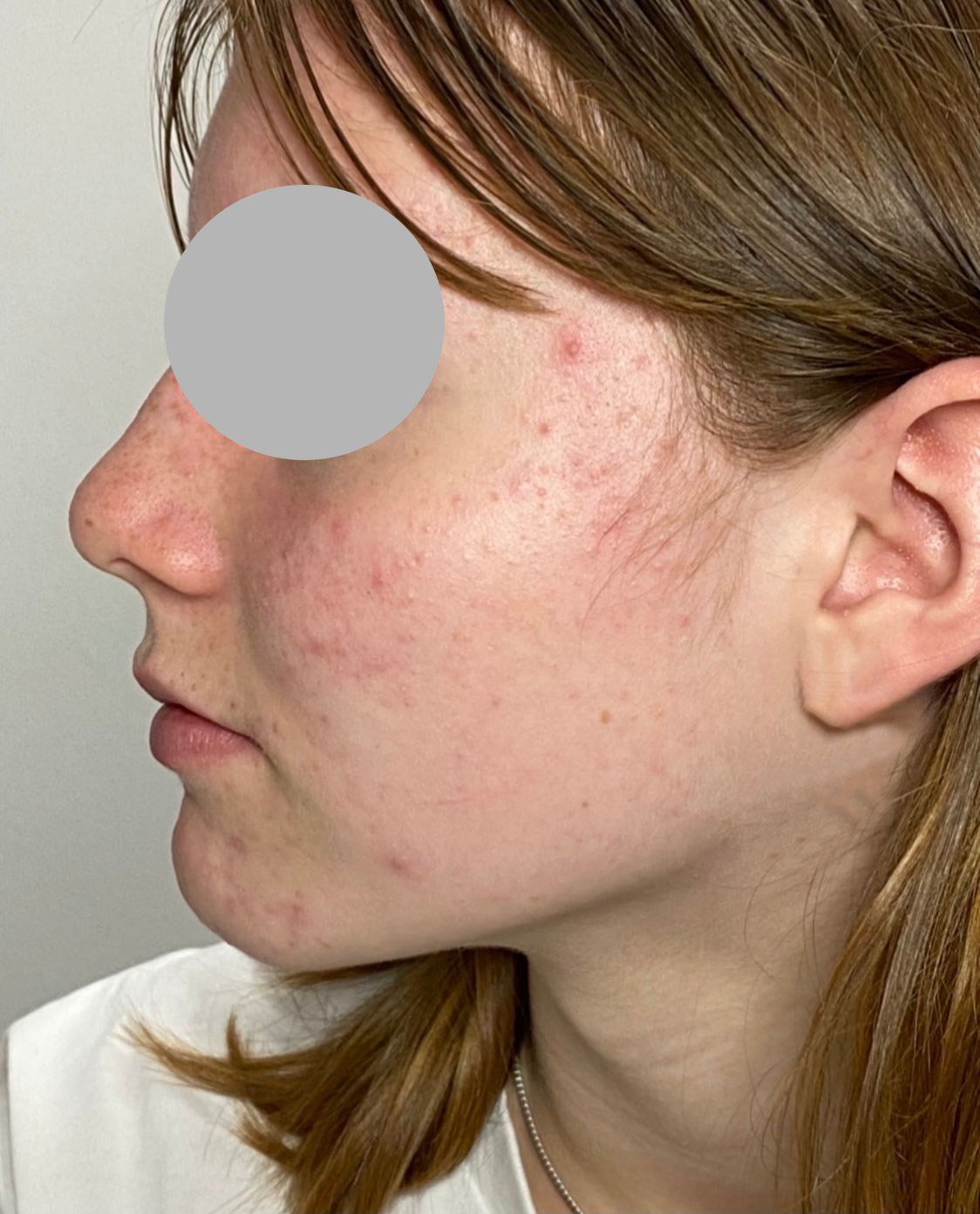 un primo piano del volto di una donna con una maschera sugli occhi .