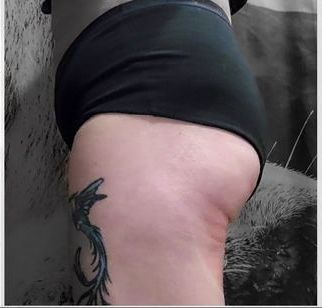 BBL Results from Body Sculpting