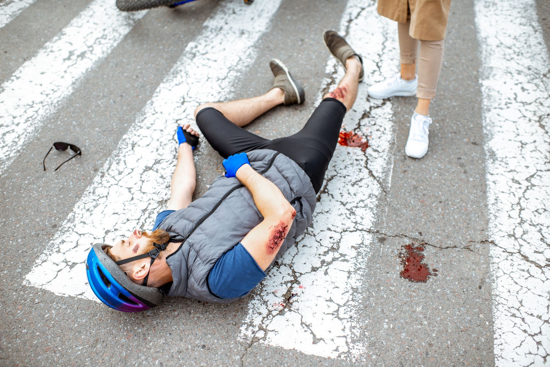 Cyclist lying injured on a crosswalk after a bicycle accident with visible injuries.