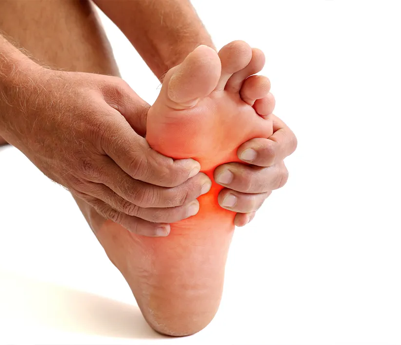Arch Pain