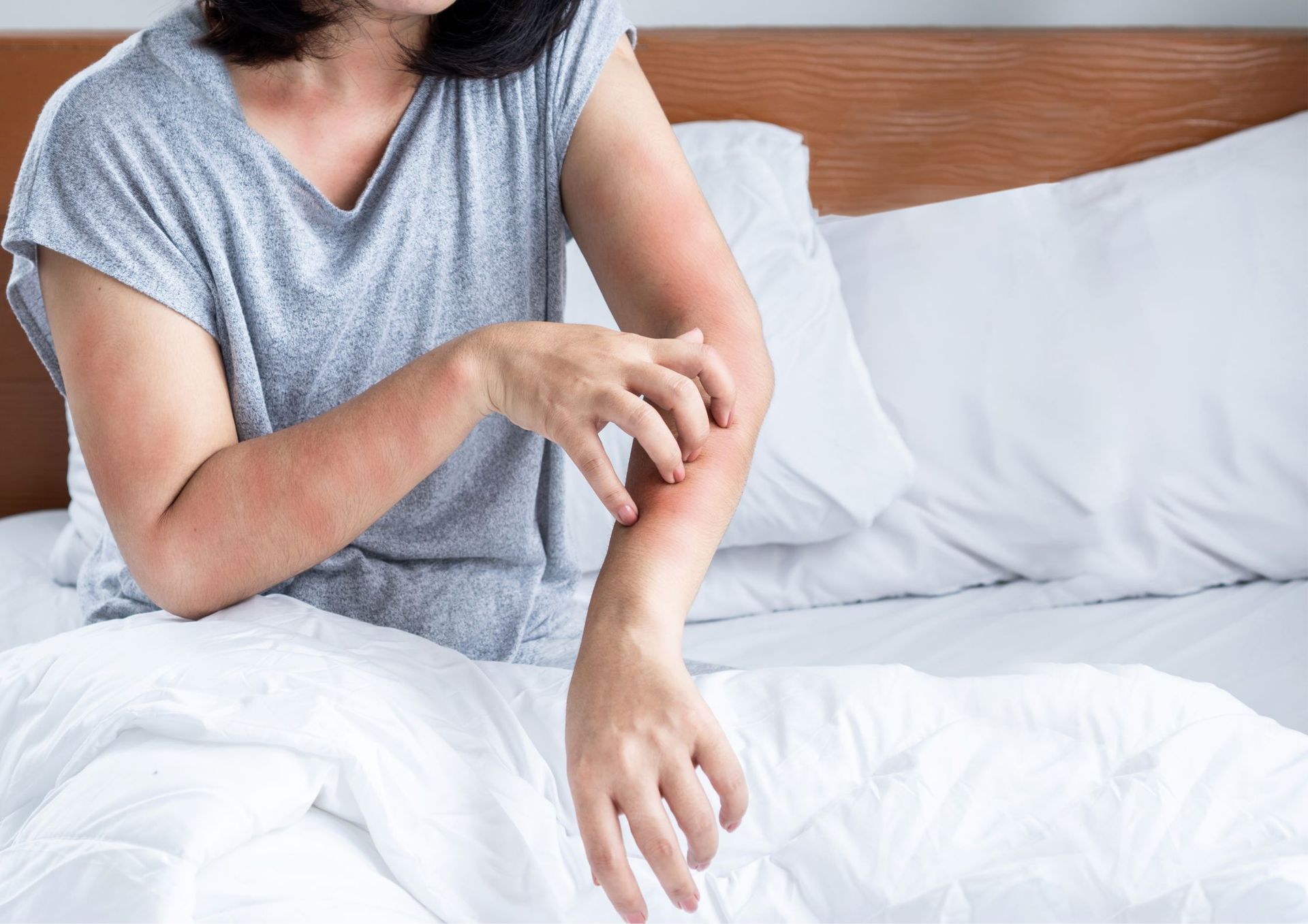 A woman is sitting on a bed scratching her arm.