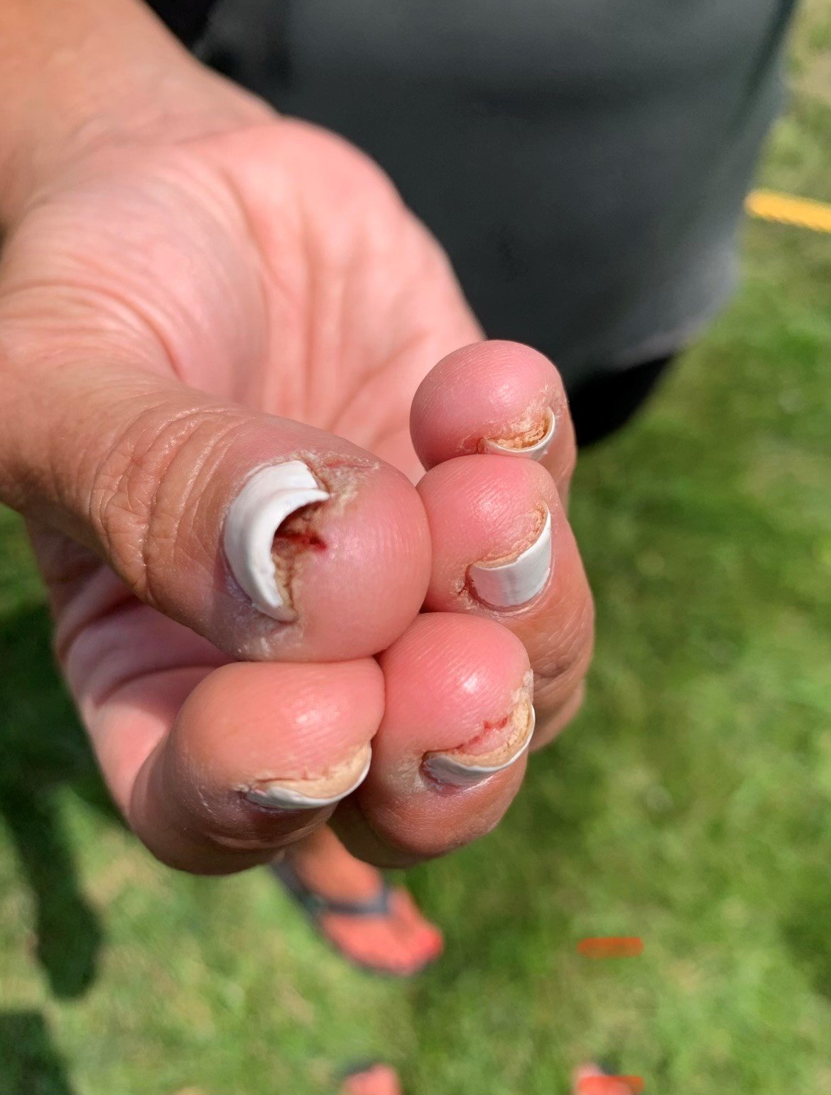 A person is holding a broken nail in their hand.