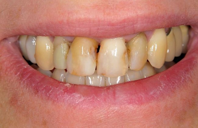 cosmetic dentistry before