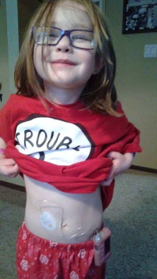 Young Ani Blook showing her insulin pump on her stomach