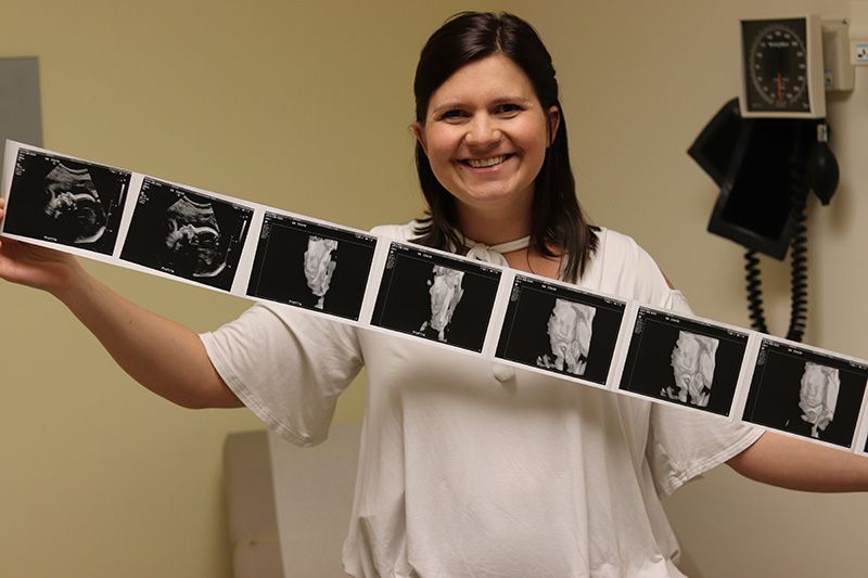 Pregnant T1D patient holding her ultrasound photos and smiling. 