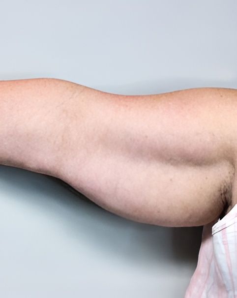 a close up of a woman 's arm against a white wall .