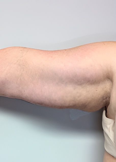 a close up of a woman 's arm against a white wall .
