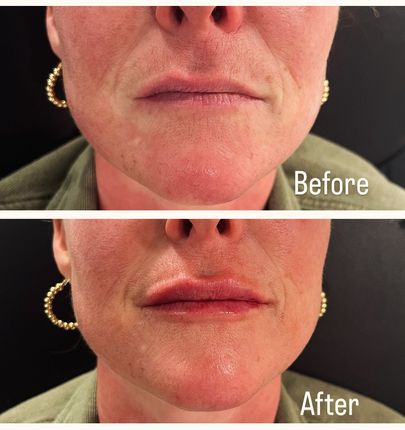 A before and after photo of a woman 's face