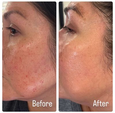 A before and after photo of a woman 's face