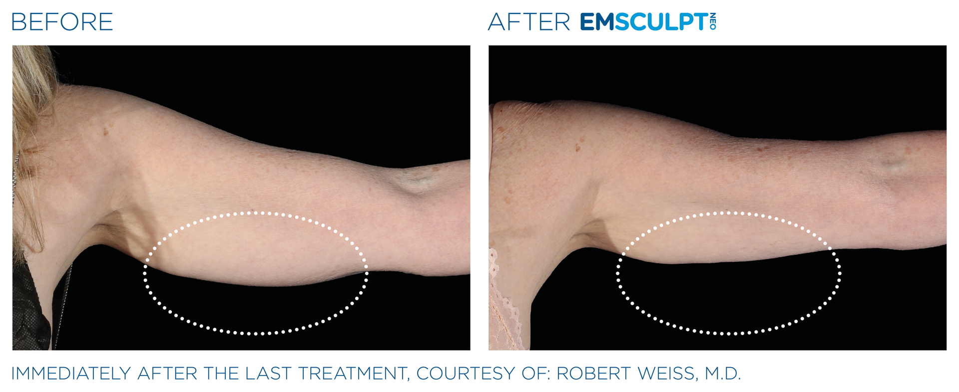 A before and after photo of a woman 's arm