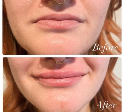 A before and after picture of a woman 's lips with a nose ring.