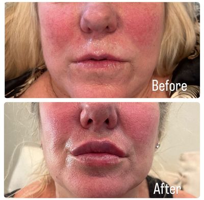 A before and after photo of a woman 's face