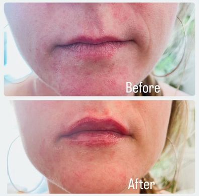 A before and after photo of a woman 's face