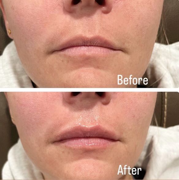 A before and after picture of a woman 's face